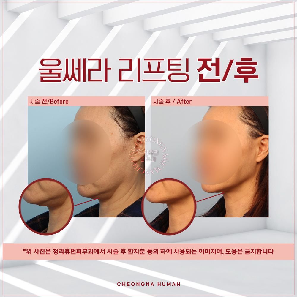 테스트